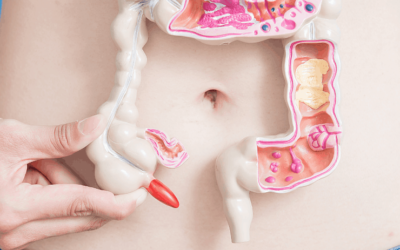 The Intimate Relationship Between Your Gut Health and Pelvic Floor